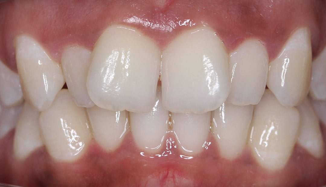 Orthodontic transformations
