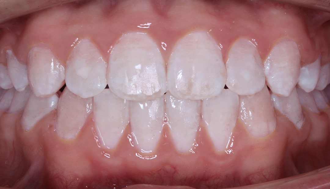 Orthodontic transformations in Sydney